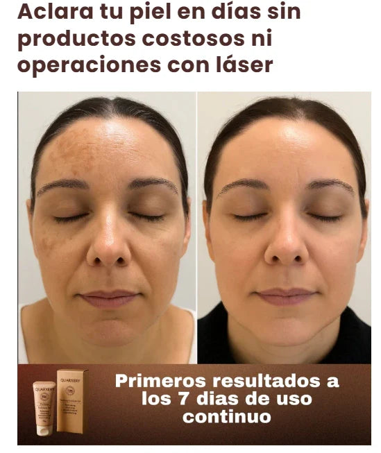 GEL QUARXERY EXFOLIANTE ACLARADOR