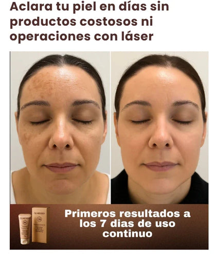 GEL QUARXERY EXFOLIANTE ACLARADOR