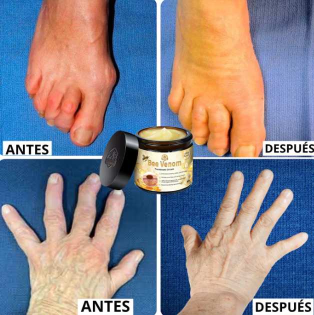 BEEVENOM BSWELL 🐝Crema Para Dolores Con Veneno De Abeja 🐝