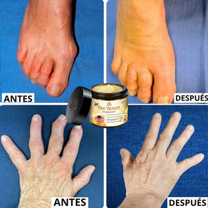 BEEVENOM BSWELL 🐝Crema Para Dolores Con Veneno De Abeja 🐝
